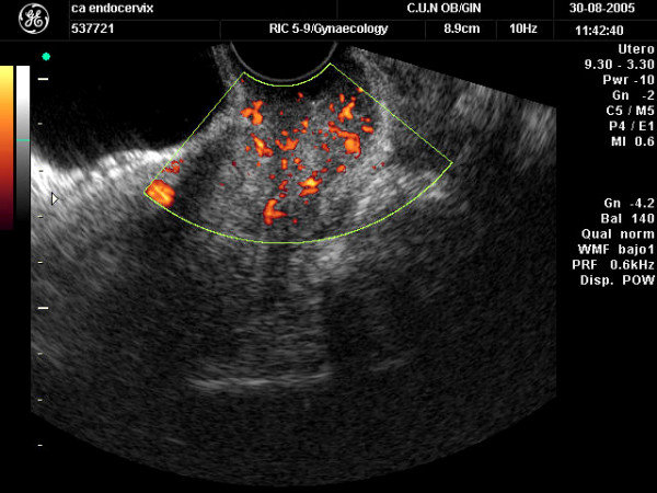 Certificate Course in Level II Scan + Color Doppler in Obstetric & Gynaecology